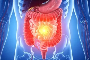 Mikrobiom és emésztés: így hat a bélflóra az egész testedre