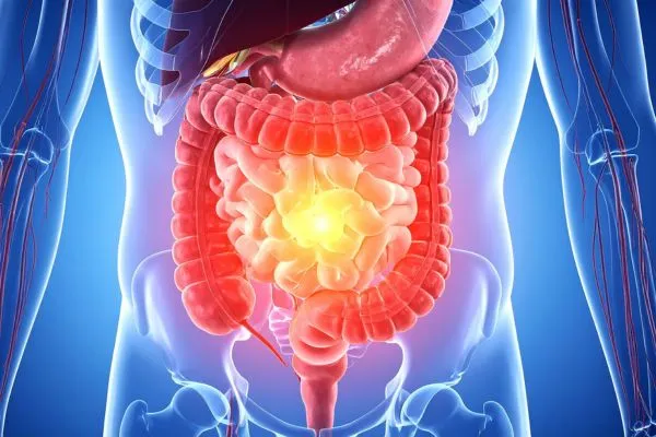 Mikrobiom és emésztés: így hat a bélflóra az egész testedre